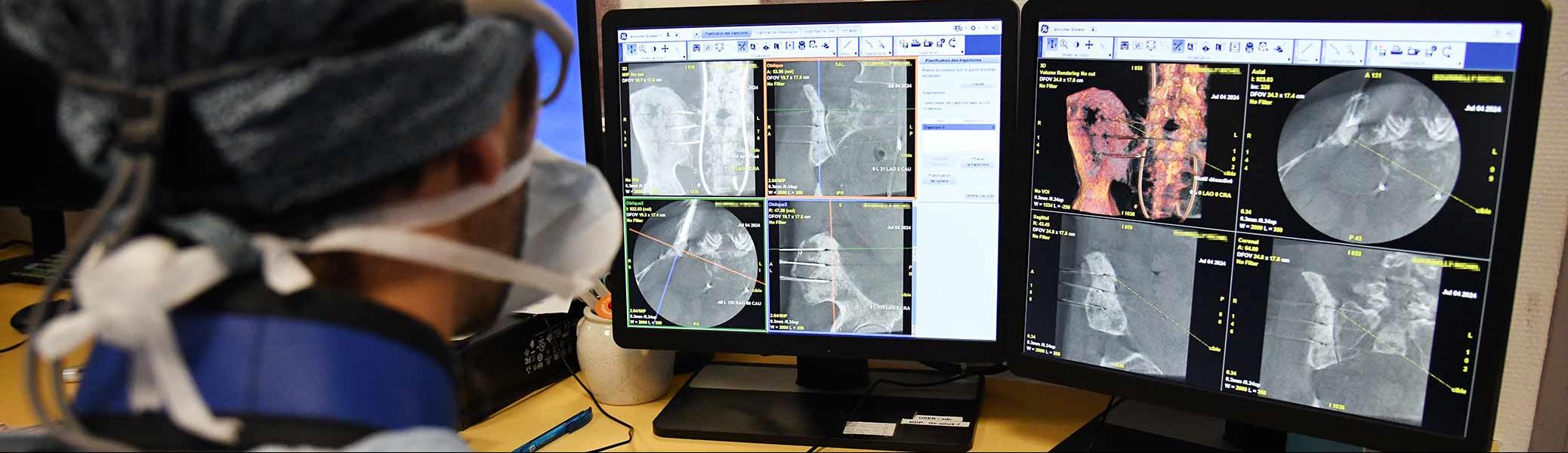 2024-07-05-radiologie-interventionnelle-osseuse-slide.jpg