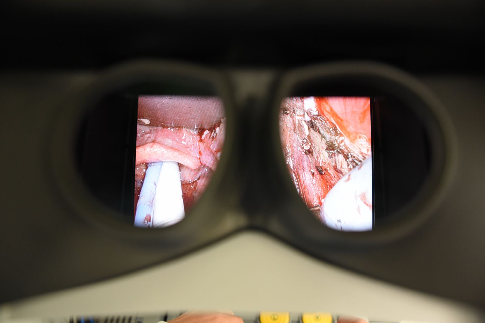 Vue 3D