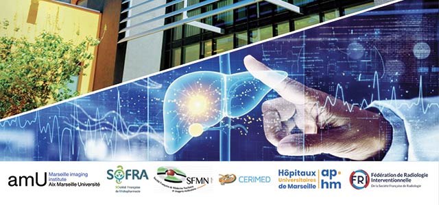 Première Journée nationale de la radioembolisation - 22 juin 2026