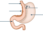 Schéma sleeve gastrectomie