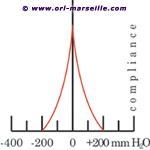 Tympanogramme d'une oreille normale 