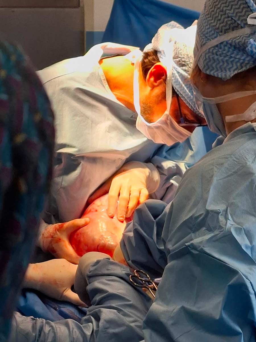 chirurgie des patientes souffrant du cancer de l'ovaire