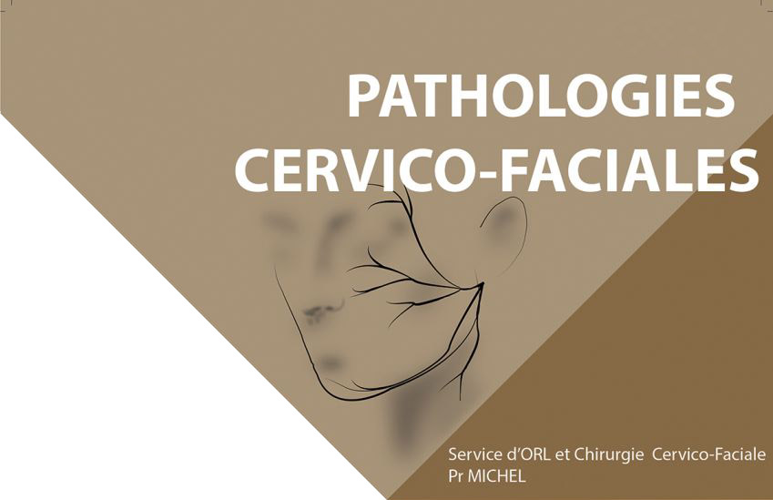fiche pathologie du service ORL et chirurgie cervico-faciale de l'Hôpital de la Conception de Marseille