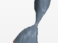 mr-figure1-articleheliox_stenoselarynhotracheale.jpg