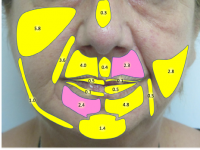 mr_abellan-lopez_m_et_al_2022_fig1.png