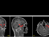 mr_epi17310-fig-0004-m-4c.png