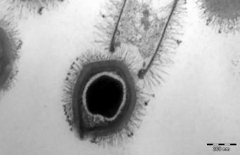 Découverte d’un nouveau virus géant : le Tupanvirus 