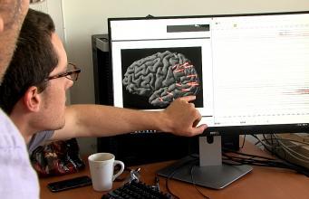 Épilepsie : création du premier cerveau virtuel personnalisé