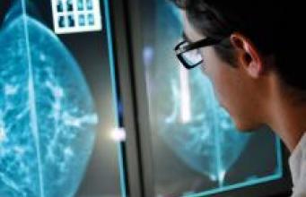 Cancer du sein : dépistage, diagnostic et traitements