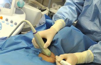 La thermoablation : retirer les nodules thyroïdiens bénins sans recourir à la chirurgie