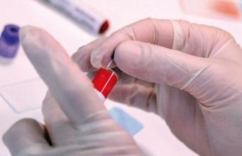 Quatre chercheurs marseillais figurent sur la liste des chercheurs les plus cités dans la communauté scientifique internationale. 