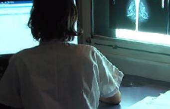 Diagnostic rapide du cancer du sein