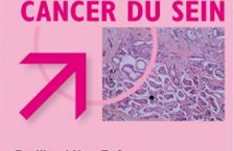 Diagnostic rapide du cancer du sein - Pavillon Mère-Enfant - Hôpital Nord