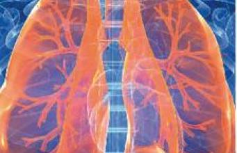 Cancer du poumon : une formation européenne de haut niveau à Marseille
