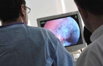 POEM :  une technique endoscopique innovante pour traiter l’achalasie
