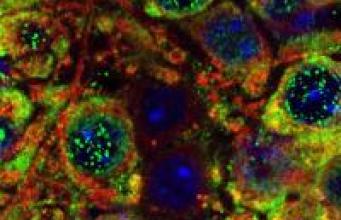 Autisme : découverte d’un nouveau gène grâce aux cellules souches olfactives