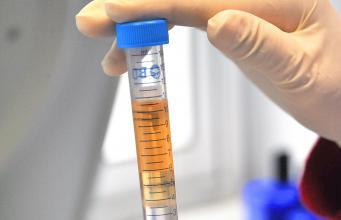 Le COFRAC confirme l'accréditation du laboratoire de l'AP-HM