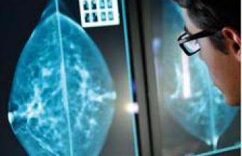 Cancer du sein: dépistage, diagnostic et traitements