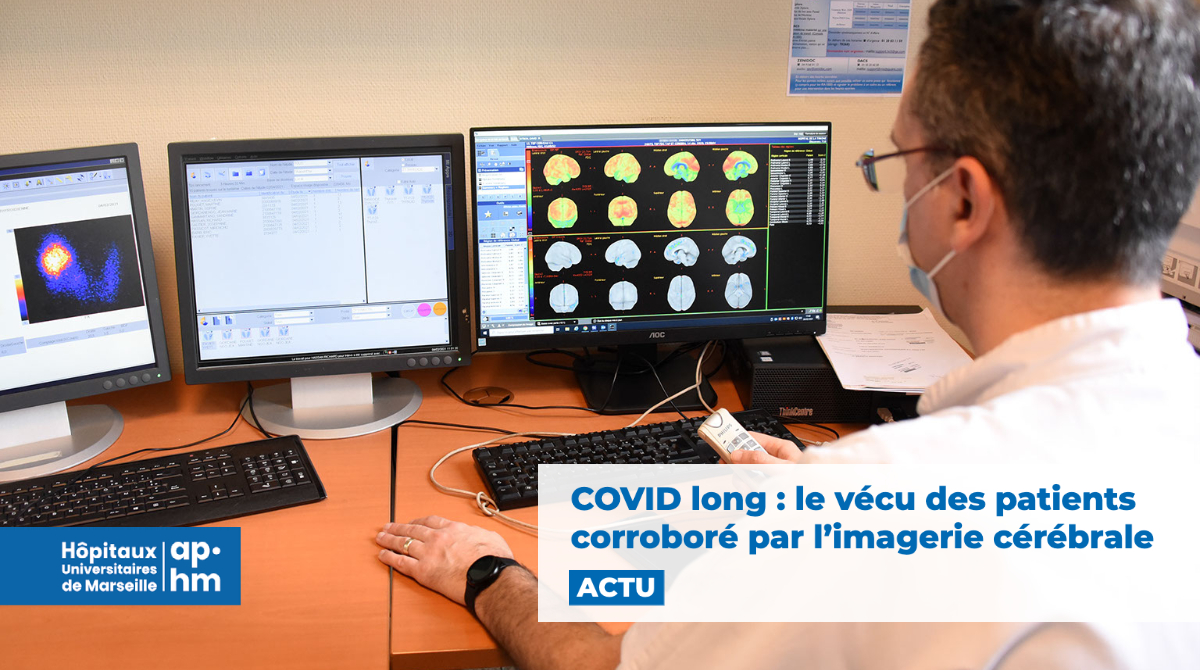 COVID long : le vécu des patients corroboré par l’imagerie cérébrale ...